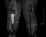 1 NMSP Circulation A21 - Bone case B2.jpg